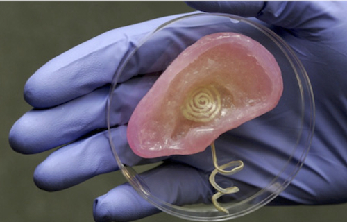 3d printed ear with embedded hearing aid